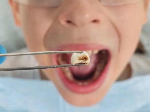 Best Weekend Emergency Dentist in Watsonville, CA